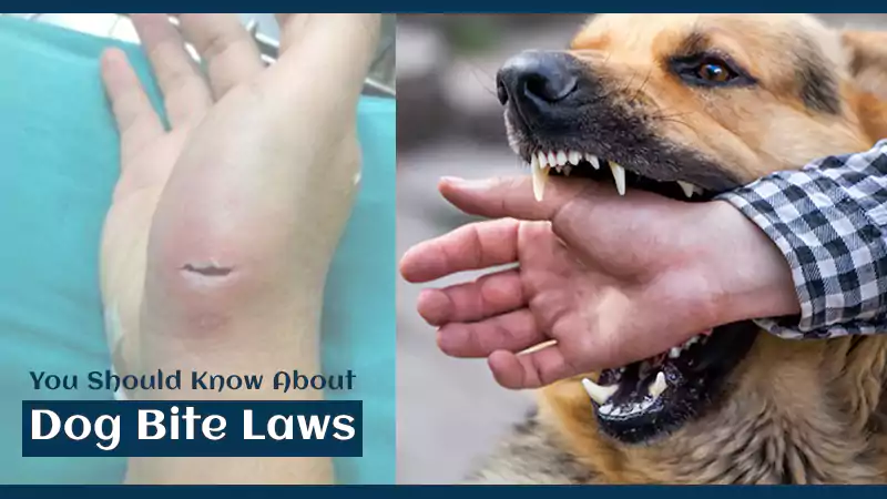 Dog Bite Laws